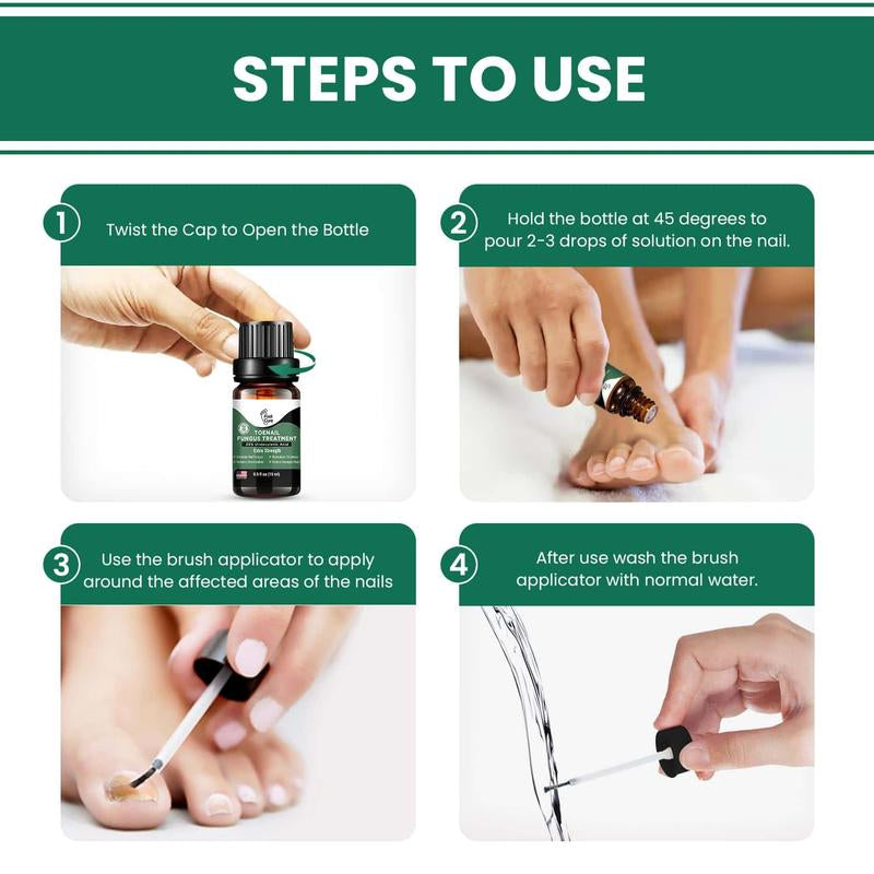Foot Cure Extra Strength Toenail Fungus Treatment – 25% Undecylenic Acid Antifungal Nail Repair for Yellow, Thick & Ingrown Nails – Softens Damaged Nails on Fingers & Toes – 15Ml
